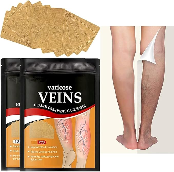 Varicose veins patches(BUY 1 GET 1 FREE)