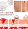Skin Tag Remover Patch(BUY 1 GET 1 FREE)