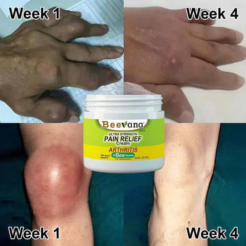Bee Venom Pain Relief Cream(BUY 1 GET 2 FREE)