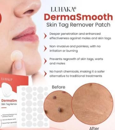 Skin Tag Remover Patch(BUY 1 GET 1 FREE)