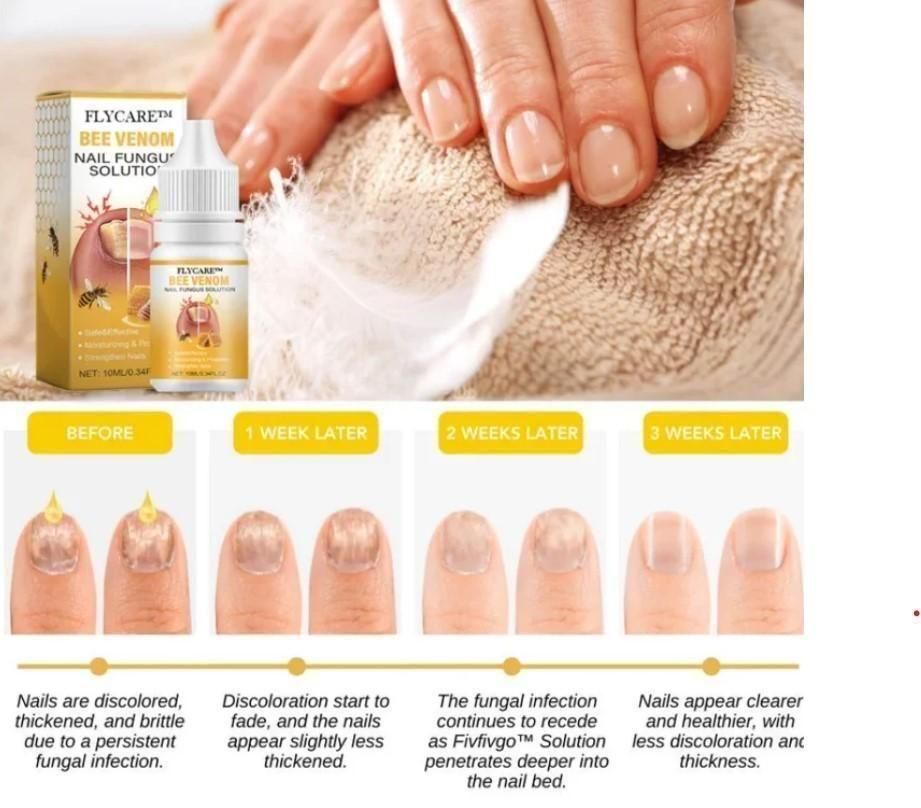 BeeVenom Nail Fungus Solution  (BUY 1 GET 1 FREE)