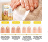 BeeVenom Nail Fungus Solution  (BUY 1 GET 1 FREE)