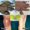 Bee Venom Pain Relief Cream(BUY 1 GET 2 FREE)