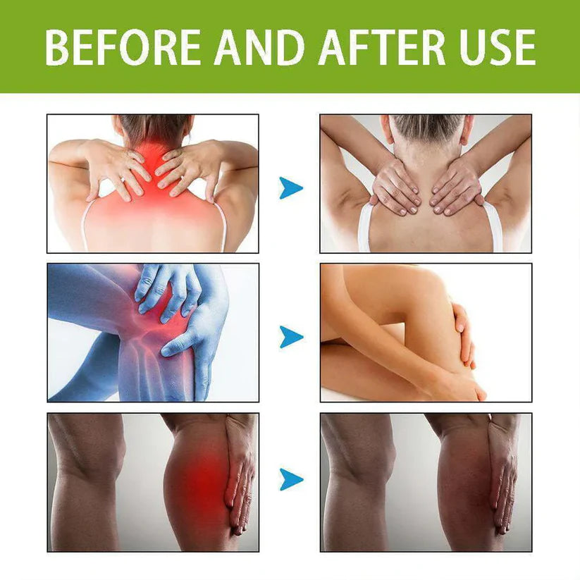 Bee Venom Pain Relief Cream(BUY 1 GET 2 FREE)