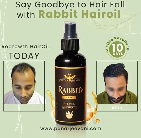 Magic Oil (BUY 1 GET 1 FREE)