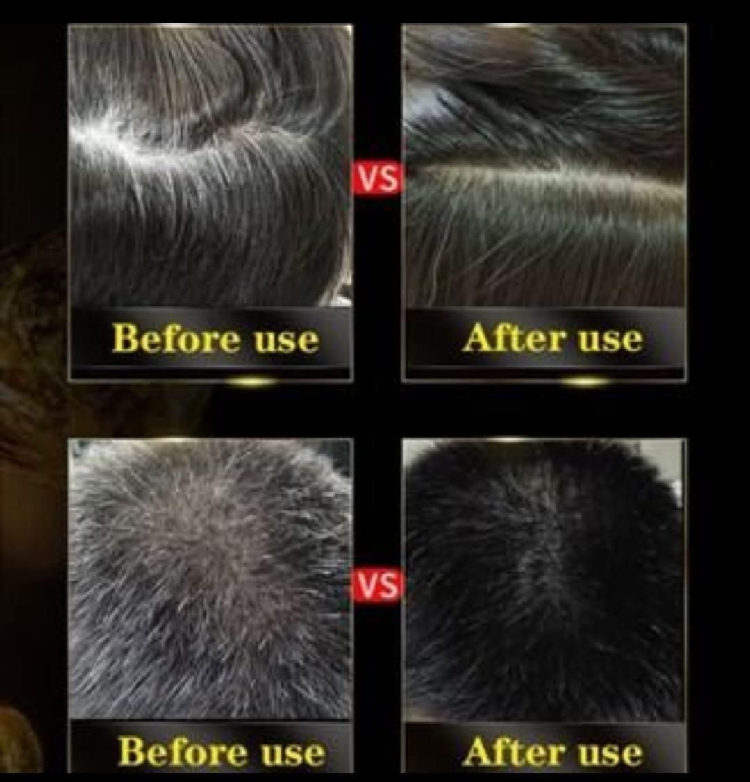 Black Hair Shampoo 3 in 1-100ml (BUY 1 GET 1 FREE)