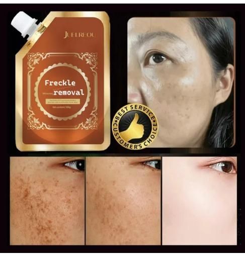 2025 New Anti-Blemish & Anti-Aging Tear-Off Mask