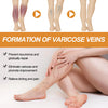 Varicose Veins Spray - Natural Herbal Formula for Fast Relief ( BUY 1 GET 1 FREE )