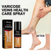 Varicose Veins Spray - Natural Herbal Formula for Fast Relief ( BUY 1 GET 1 FREE )