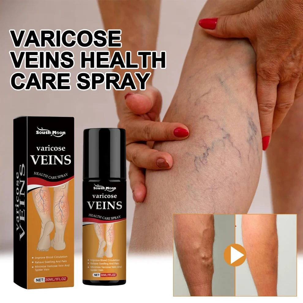 Varicose Veins Spray - Natural Herbal Formula for Fast Relief ( BUY 1 GET 1 FREE )