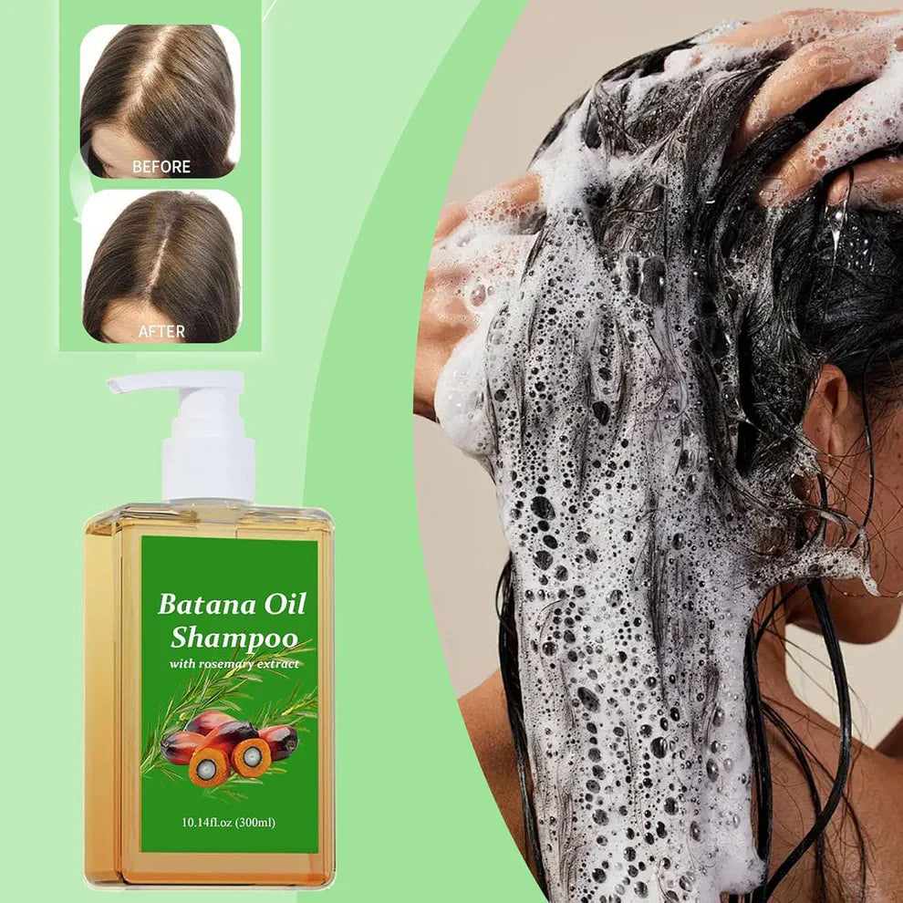 Batana Oil Shampoo for Hair Growth with Rosemary Extract(BUY 1 GET 1 FREE)