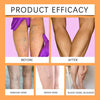 Varicose Veins Spray - Natural Herbal Formula for Fast Relief ( BUY 1 GET 1 FREE )