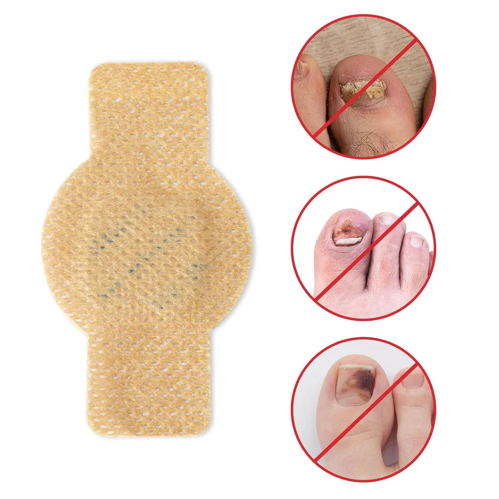 Fungus Nail Patches (BUY 1 GET 1 FREE)
